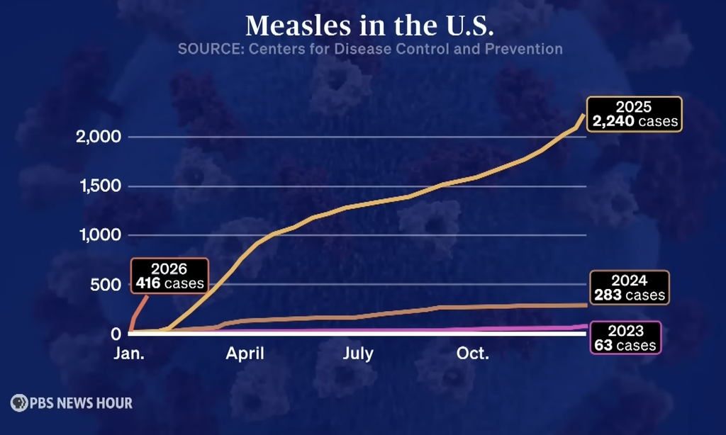 A line chart from the CDC titled “Measles in the U.S.” tracks cases by year, showing 63 cases in 2023, 283 cases in 2024, and a sharp rise to 2,240 cases in 2025.